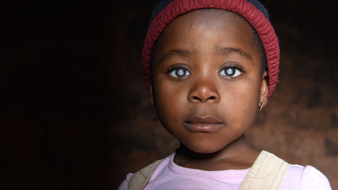 Ein kleines Mädchen mit auffällig weißen Pupillen und mit einer Wollmütze.