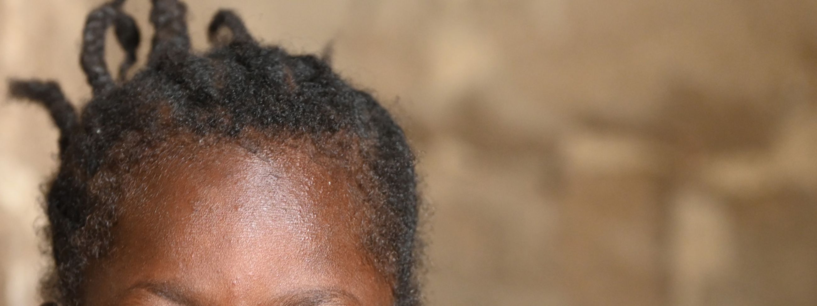 Ein kleines Mädchen mit weißen Pupillen.