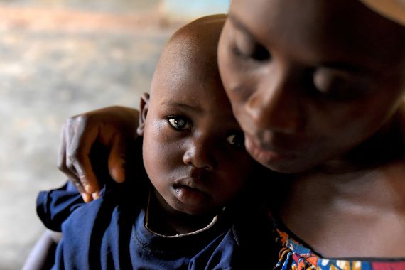 Kleiner afrikanischer Junge mit weiß schimmernden Pupillen